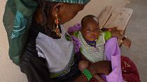 La importancia de las madres en Níger para detectar casos de desnutrición infantil