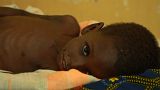 Ernährungskrise im Niger: Kinder hungern