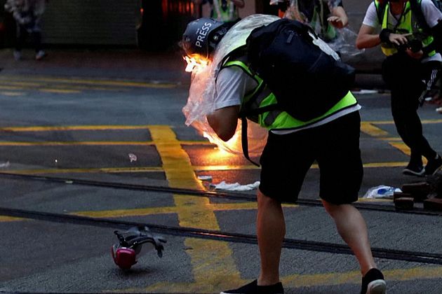 Hong Kong: giornalista ferito, perde la vista a un occhio