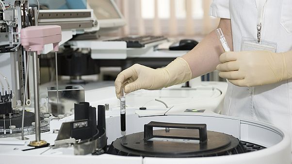Ученые выявили новый штамм ВИЧ впервые с 2000 года Ученые выявили новый штамм ВИЧ впервые с 2000 года