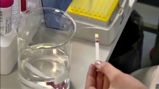 Η Ρωσία παραδέχεται τη χρήση αναβολικών Η Ρωσία παραδέχεται τη χρήση αναβολικών