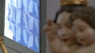شاهد: كنيسة ألمانية نوافذها قطعة فنية صُممت من صور الأشعة السينية كرمز بين الصحة والمرض