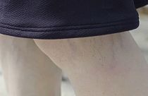 Tartós egészségügyi problémákat okoz az irodai munka