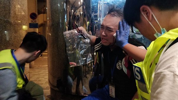 Hong Kong: Homem arranca orelha a político pró-democracia Hong Kong: Homem arranca orelha a político pró-democracia