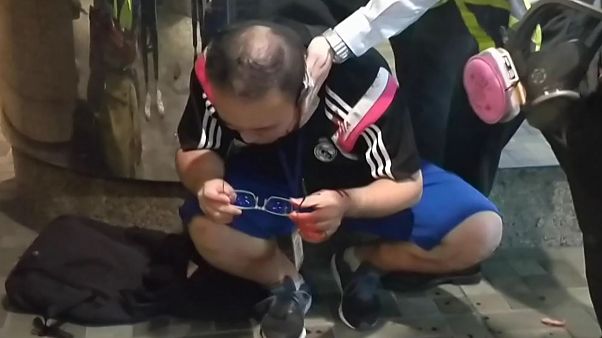 Hong Kong'da bıçaklı saldırgan siyasetçinin kulağını ısırarak kopardı Hong Kong'da bıçaklı saldırgan siyasetçinin kulağını ısırarak kopardı