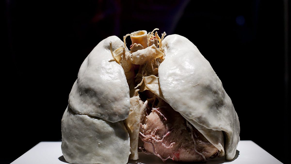 Nemdohányzó ember tüdőpreparátuma az emberi szervezet felépítését, működését bemutató Az emberi test (The Human Body) című kiállításon
