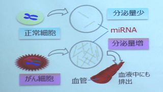 اليابان تطور اختبارا للدم يكشف بدقة عن أنواع عدة من السرطانات خلال ساعات