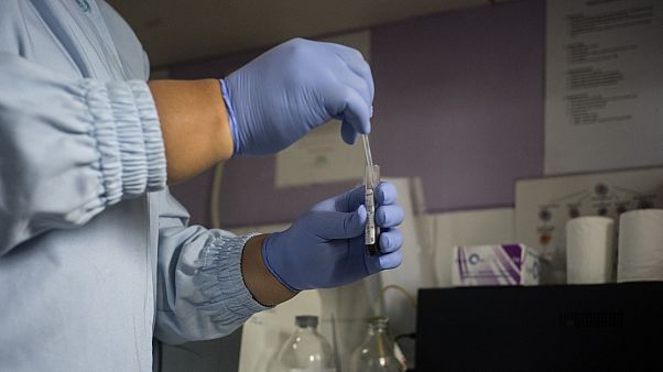 DSÖ: Avrupa'da HIV taşıyan kadınların yarısından fazlası geç teşhis mağduru DSÖ: Avrupa'da HIV taşıyan kadınların yarısından fazlası geç teşhis mağduru