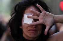 Estallido social en Chile | Las víctimas de lesiones oculares se querellarán contra Piñera