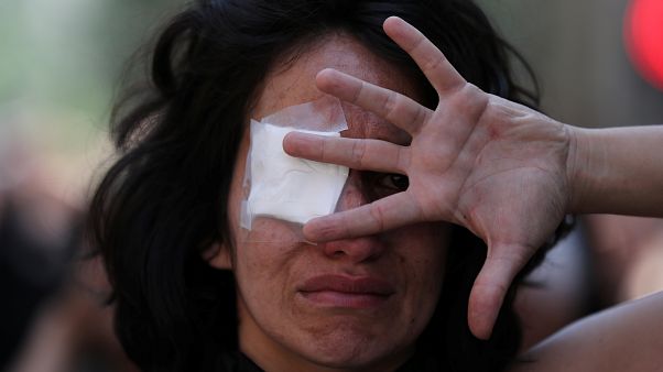 Estallido social en Chile | Las víctimas de lesiones oculares se querellarán contra Piñera Estallido social en Chile | Las víctimas de lesiones oculares se querellarán contra Piñera