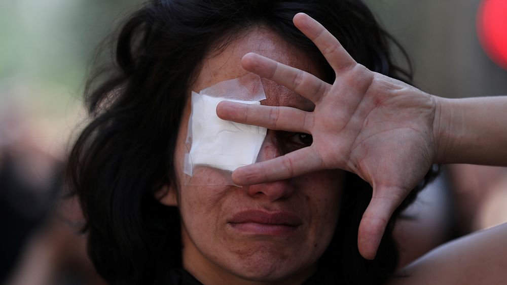 Blessés aux yeux, 200 Chiliens réclament justice