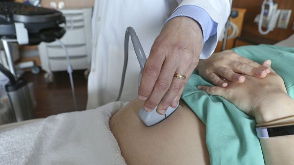Türkiye'de sezaryen doğum oranı yüzde 53 iken AB'de yüzde 28. Türkiye'de sezaryen doğum oranı yüzde 53 iken AB'de yüzde 28.