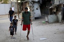 Gazze Şeridi'nde düzenlenen protestolar sırasında İsrail askerlerinin ateşinde ayağını kaybeden Filistinli Ziad el Medeni