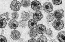 عکس میکروسکوپی از مقابله با ویروس ایدز از طریق روش انقلابی کریسپری