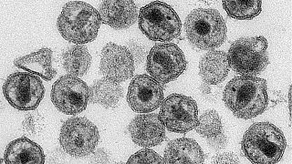 عکس میکروسکوپی از مقابله با ویروس ایدز از طریق روش انقلابی کریسپری