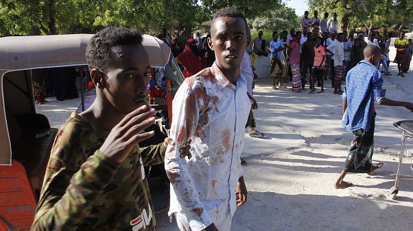 Explosión de un coche bomba deja 79 fallecidos y más de un centenar de heridos en Somalia Explosión de un coche bomba deja 79 fallecidos y más de un centenar de heridos en Somalia