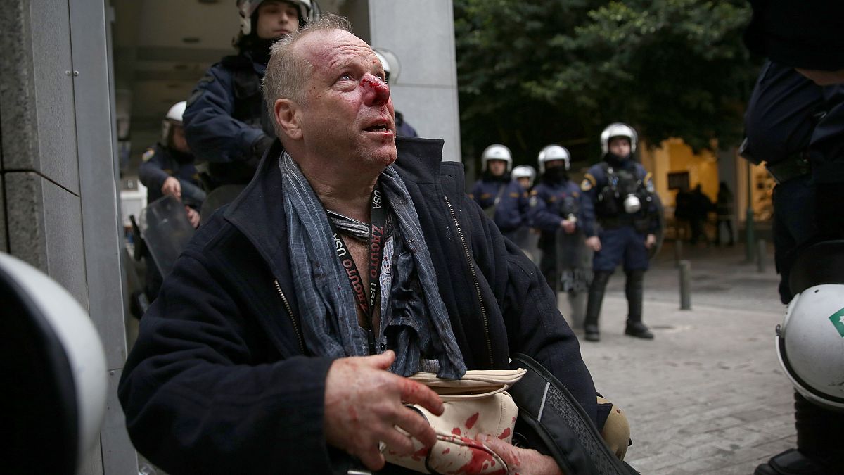 Ο δημοσιογράφος Τόμας Γιακόμπι τραυματισμένος από εθνικιστές με κουκούλες που συμμετείχαν σε διαδήλωση κατά των μεταναστών στο Σύνταγμα