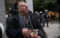 Le journaliste Thomas Jacobi après son agression à Athènes le 19/01/2020