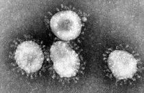 فيروس من سلالة كورونا