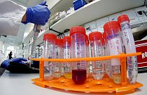 Científicos italianos logran aislar el 'coronavirus de Wuhan'