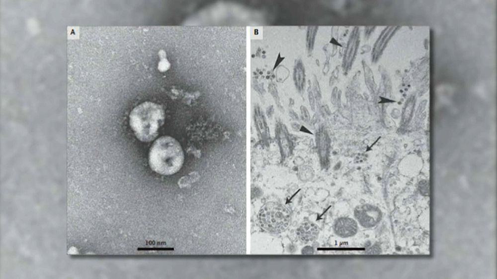 Coronavirus : une course contre la montre scientifique