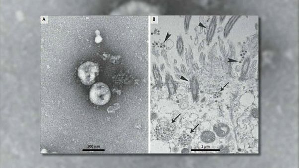 Coronavirus : une course contre la montre scientifique Coronavirus : une course contre la montre scientifique
