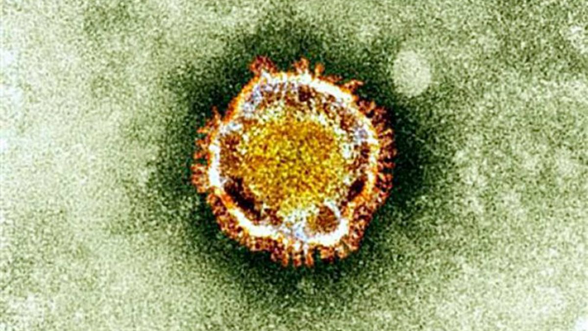 Coronavirüs 2019-nCoV