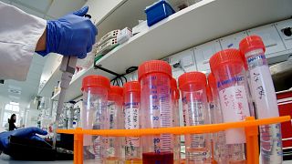 نخستین مورد ابتلا به ویروس کرونا در آلمان؛ شمار قربانیان از ۱۰۰ نفر گذشت