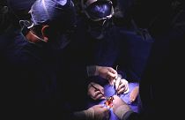 Japonya'da ilk kez iPS kök hücreler kalp ameliyatında kullanıldı: Artık komple kalp nakli olmayacak