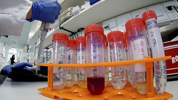 İtalya: Koronavirüsün DNA dizilimini ayrıştırmayı başardık, bilgiler herkese açık İtalya: Koronavirüsün DNA dizilimini ayrıştırmayı başardık, bilgiler herkese açık