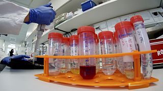 أخصائيون يفحصون عينات ضمن بحوث تخص فيروس كورونا، في أحد مخابر العاصمة الألمانية برلين. 2020/01/21
