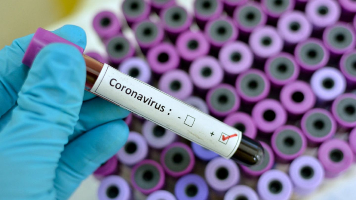 COVID-19: Your questions answered on the coronavirus outbreak ...