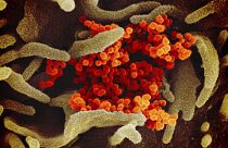 Coronavirus: un farmaco "dimenticato" potrebbe servire da vaccino