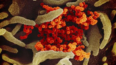Un traitement contre la malaria pourrait permettre de lutter contre le coronavirus