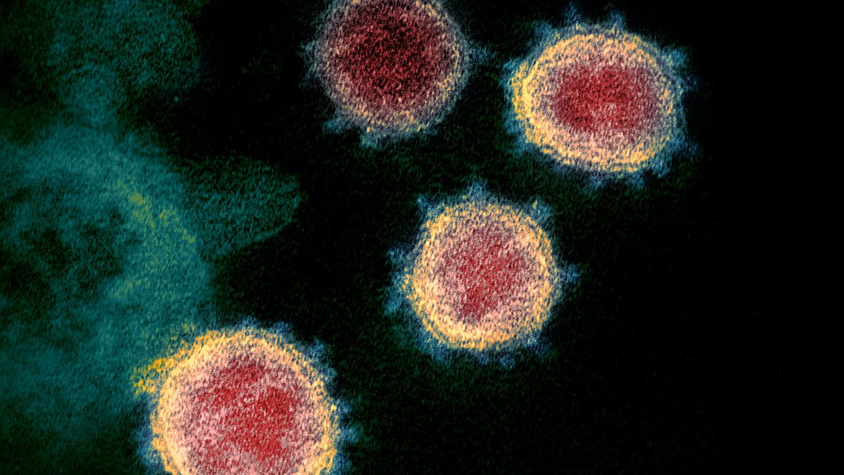 This undated electron microscope image made available by the U.S. National Institutes of Health in February 2020 shows the Novel Coronavirus SARS-CoV-2. 