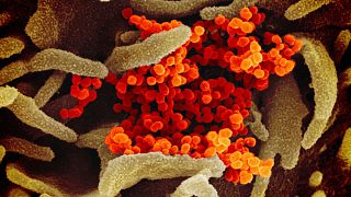Le coronavirus SARS-CoV-2 responsable de l'épidémie de Covid-19 vu au microscope électronique et échantillonné par un laboratoire américain de recherche sur les allergies.