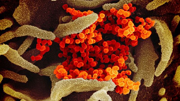 Le coronavirus SARS-CoV-2 responsable de l'épidémie de Covid-19 vu au microscope électronique et échantillonné par un laboratoire américain de recherche sur les allergies. Le coronavirus SARS-CoV-2 responsable de l'épidémie de Covid-19 vu au microscope électronique et échantillonné par un laboratoire américain de recherche sur les allergies.