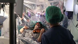 مريض يعزف على ألة الكمان أثناء عملية جراحية