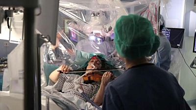 مريض يعزف على ألة الكمان أثناء عملية جراحية 