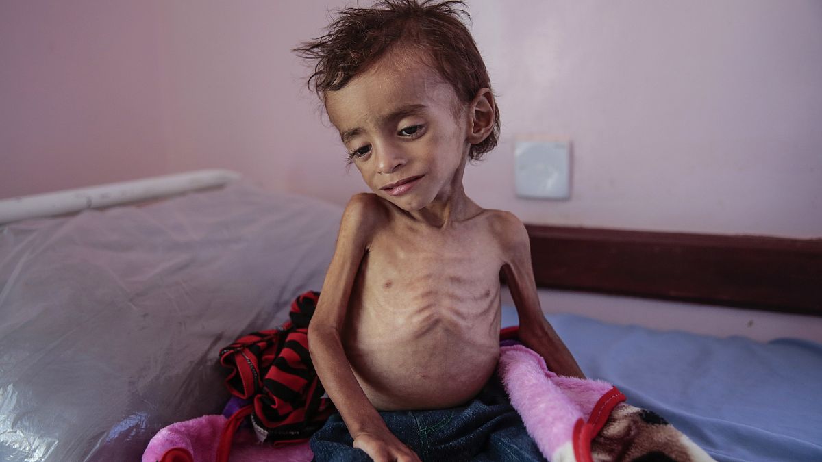 الحوثيون عرقلوا وصول نصف المساعدات الغذائية التي قدمتها الأمم المتحدة لليمن
