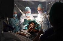 Végig hegedült saját agyműtéte alatt egy angol nő