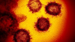 صور مجهرية لفيروس كورونا سارس - كو في 2