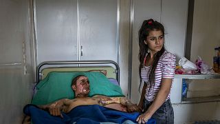 Un combatiente kurdo recibe una visita en el hospital