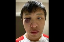 العنصرية بسبب فيروس كورونا تضرب من جديد بعد تعنيف شاب آسيوي في لندن