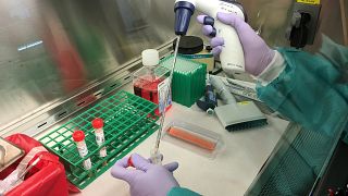 مختبر الأمراض الجرثومية في كاليفورنيا، حيث يفترض اجراء اختبارات تخص فيروس كوفيد-19. 2020/02/06