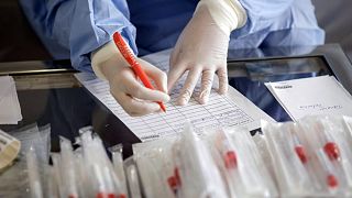 Hangi ülkede kaç kişiye koronavirüs testi yapıldı