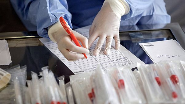 Hangi ülkede kaç kişiye koronavirüs testi yapıldı Hangi ülkede kaç kişiye koronavirüs testi yapıldı