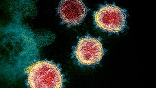 El nuevo coronavirus 2019-nCoV al microscopio