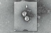 Belgische Forscher haben einen ANtikörper zu Covid-19 entdeckt