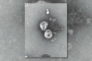 Cientistas belgas estudam anticorpo contra Covid-19